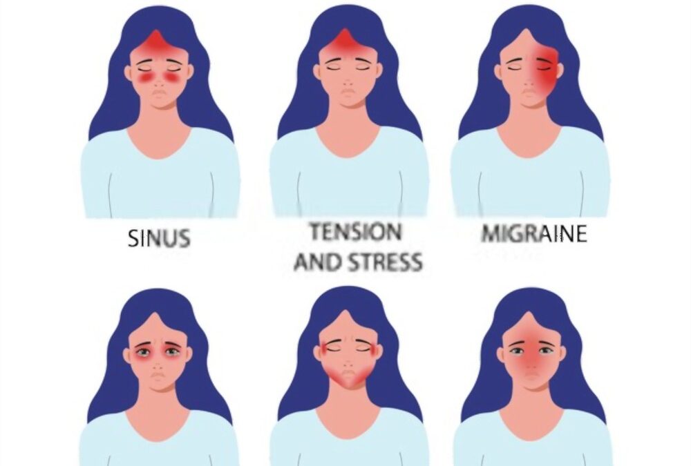 Comprendre les céphalées et les migraines : une perspective approfondie pour les maux de tête